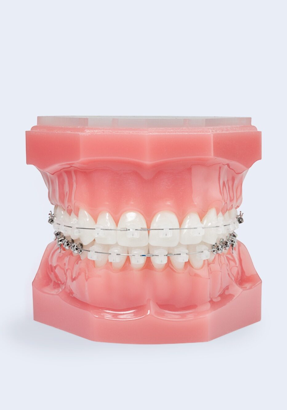 Clear Braces - Dietrich & Kelso Orthodontics